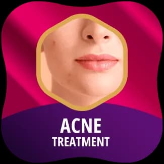 Acne Treatment